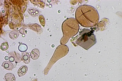 amanita-gemmata11