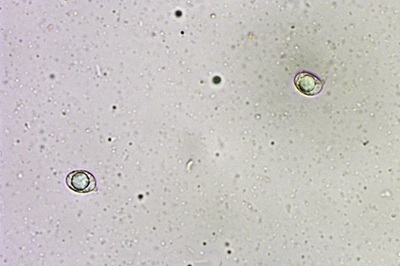 amanita-gemmata9