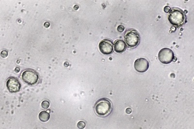 amanita-lividopallescens11