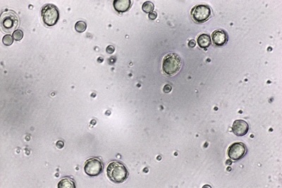 amanita-lividopallescens12