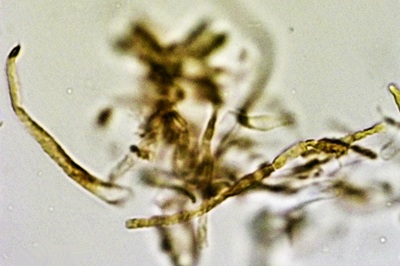 anthoporia-albobrunnea11