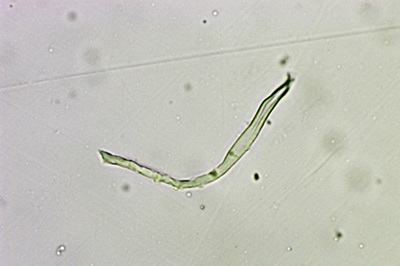 anthoporia-albobrunnea12