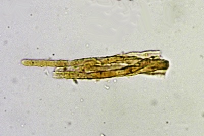 arachnopeziza-trabinelloides12