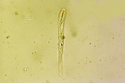 arachnopeziza-trabinelloides9