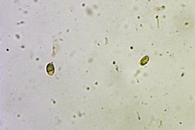 aspropaxillus-giganteus11