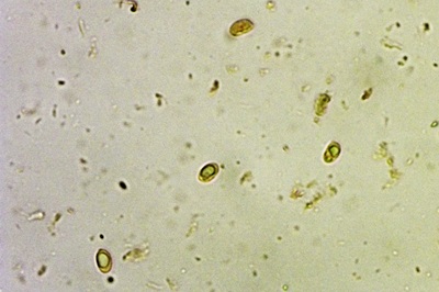 aspropaxillus-giganteus12