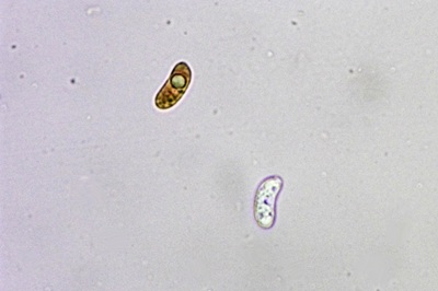 auricularia-cerrina10