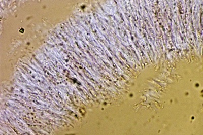 auricularia-cerrina12