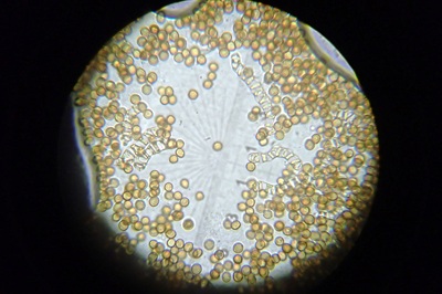 battarrea-phalloides12