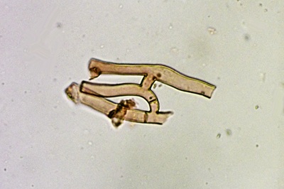 botryobasidium-aureum11
