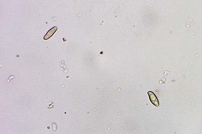 butyriboletus-appendiculatus11