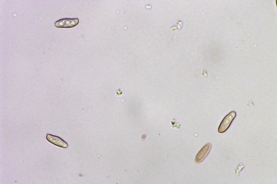butyriboletus-appendiculatus12