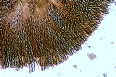 byssonectria-terrestris12