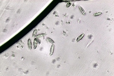 caloboletus-calopus5