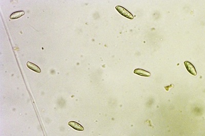 caloboletus-calopus7