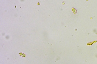 cantharellus-friesii4
