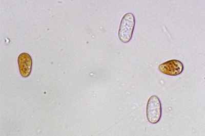 ceratiomyxa-fruticulosa10