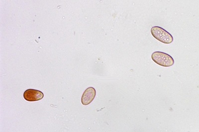 ceratiomyxa-fruticulosa11