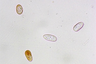 ceratiomyxa-fruticulosa12