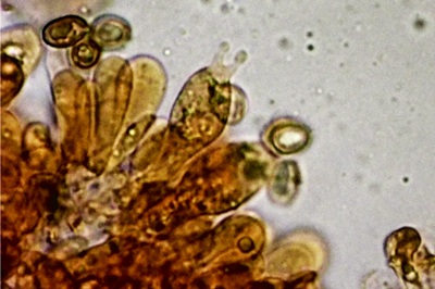 chlorophyllum-olivieri10