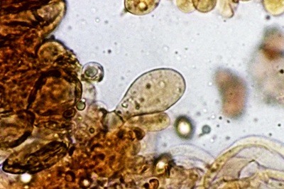 chlorophyllum-olivieri11