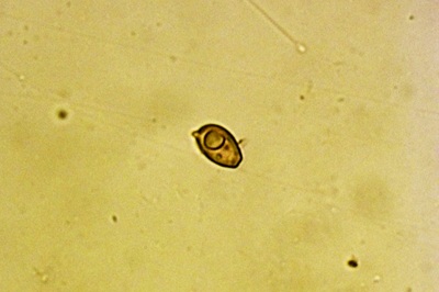 chlorophyllum-olivieri8