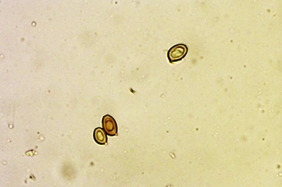 chlorophyllum-olivieri9