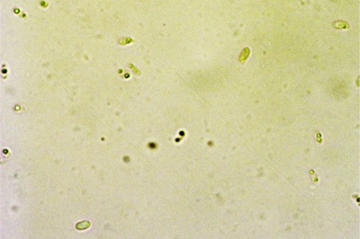 climacodon-pulcherrimus10