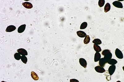 coprinopsis-alopecia2