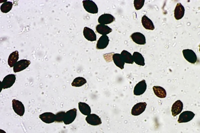 coprinopsis-alopecia3