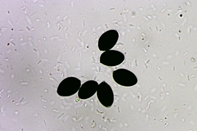 coprinopsis-picacea5