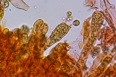craterellus-tubaeformis10