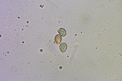 craterellus-tubaeformis8