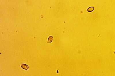 cuphophyllus-russocoriaceus10