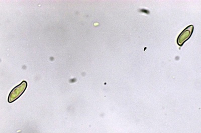 cyanoboletus-pulverulentus11