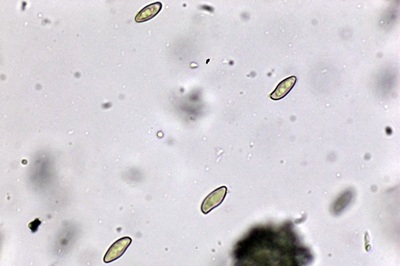 cyanoboletus-pulverulentus12