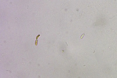 dacryobolus-karstenii5