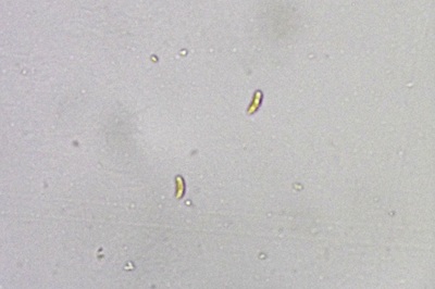 dacryobolus-karstenii6