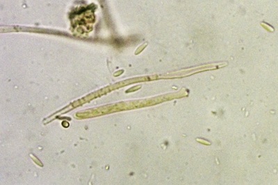 dasyscyphella-nivea12