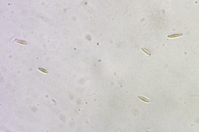 dasyscyphella-nivea7