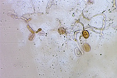 ditangium-cerasi11
