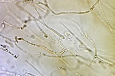 exidia-glandulosa11