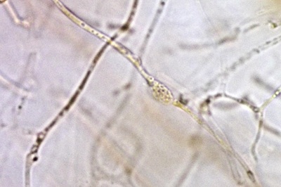 exidia-glandulosa12
