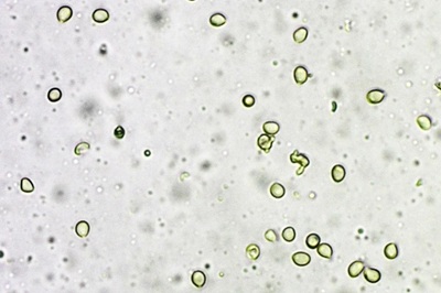 fistulina-hepatica12