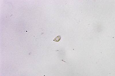 flammulaster-carpophilus8