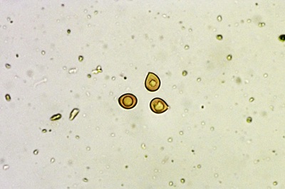 fomitiporia-punctata10