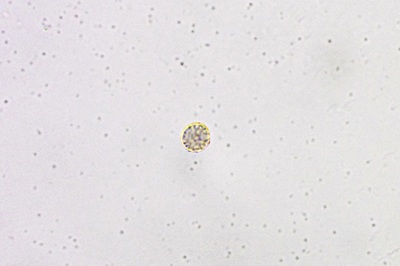 hemitrichia-clavata9