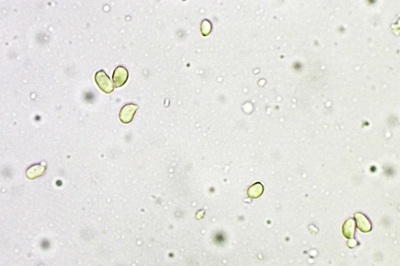 hohenbuehelia-petaloides11