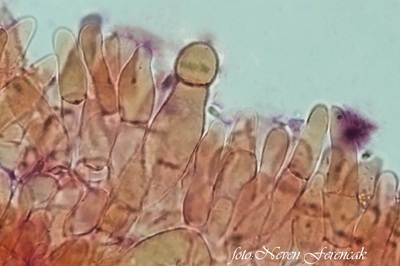 hortiboletus-bubalinus12