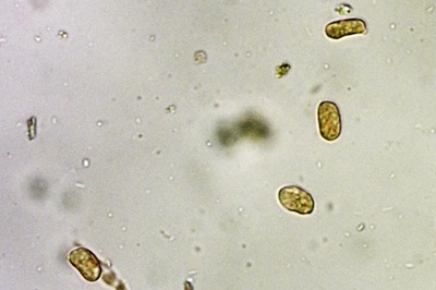 hygrocybe-acutoconica9